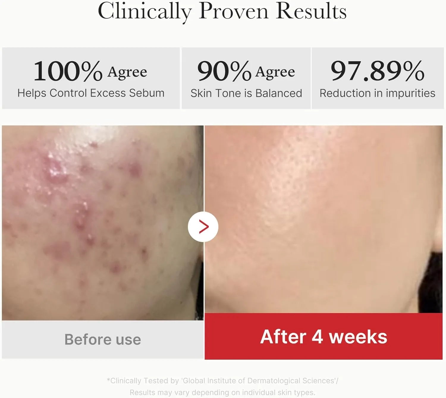 باد حمض السكسينيك الأحمر والبانثينول