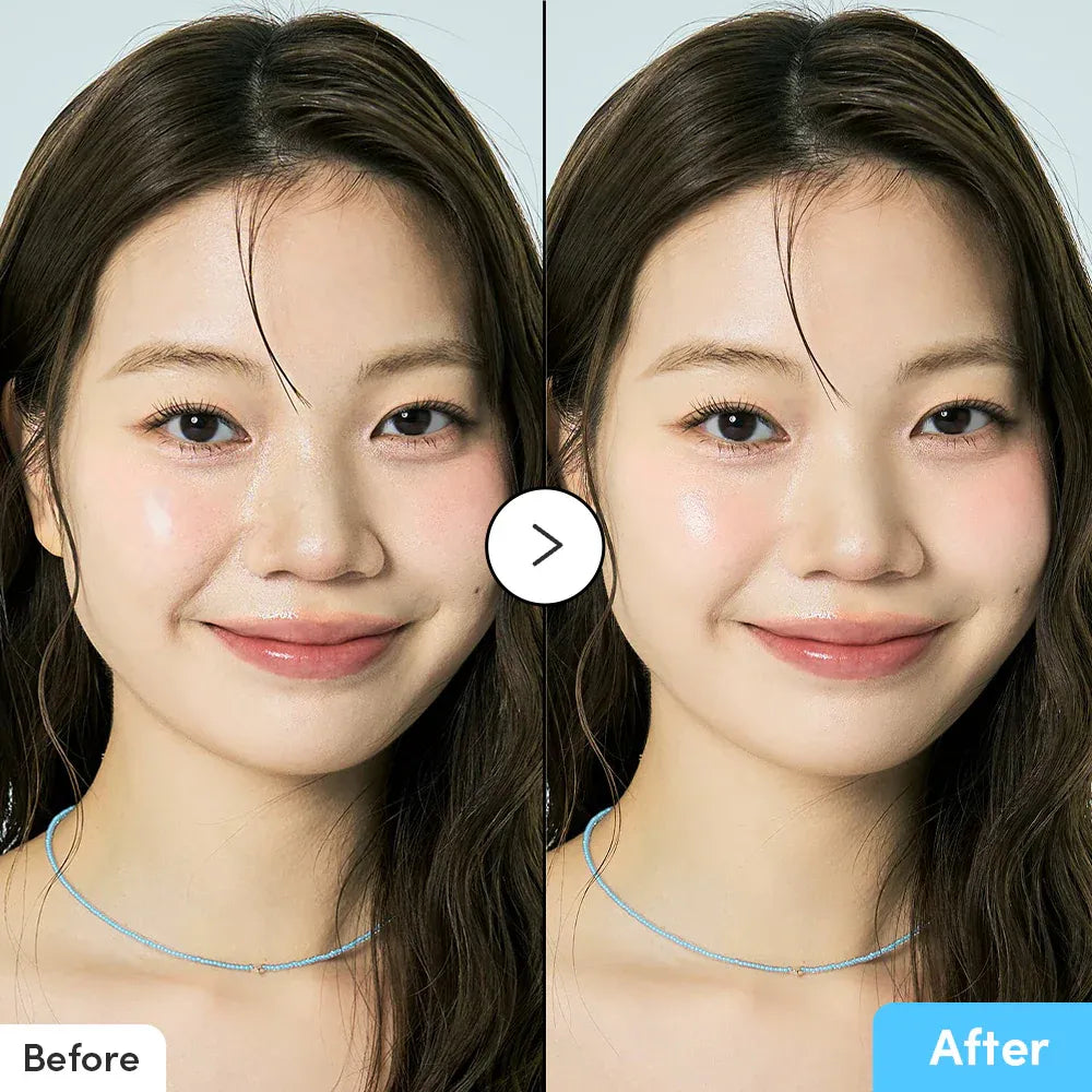 أمبول لحمامات السباحة